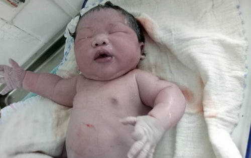 Vĩnh Phúc: Bé trai vừa sinh đã nặng 7,1kg