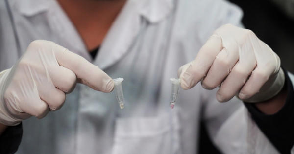 Bộ Kít RT- LAMP Covid-19 của ĐH Bách khoa Hà Nội được châu Âu cấp phép