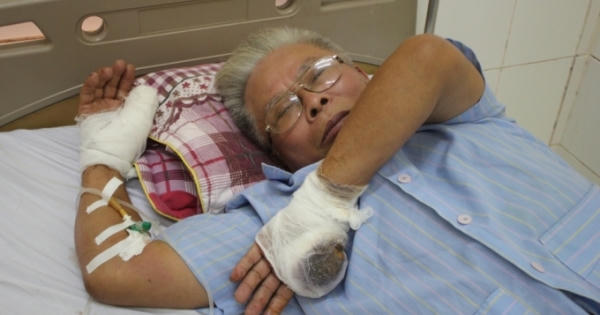 Nghệ An: Bị chém đứt lìa ngón tay khi vừa bước ra khỏi cửa hàng