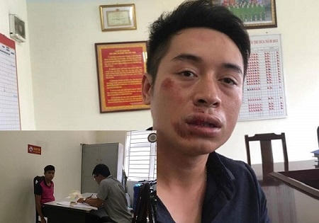 Hà Nội: Bắt đối tượng ngông cuồng đấm gãy răng 1 CSGT