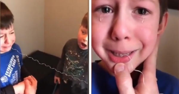 "Cười rụng rốn" với màn nhổ răng độc nhất vô nhị của hai anh em