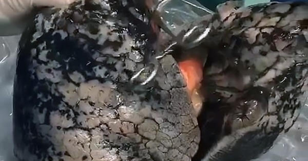 Hình ảnh kinh hoàng của "lá phổi than" được cho là quảng cáo chống hút thuốc lá tốt nhất từ trước đến nay Hình ảnh kinh hoàng của "lá phổi than" được cho là quảng cáo chống hút thuốc lá tốt nhất từ trước đến nay