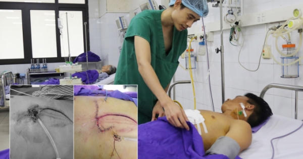 Cứu sống nam thanh niên sau tai nạn giao thông... lộ tim ra ngoài