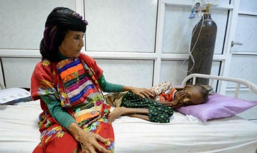 Hàng triệu người Yemen nguy cơ chết đói