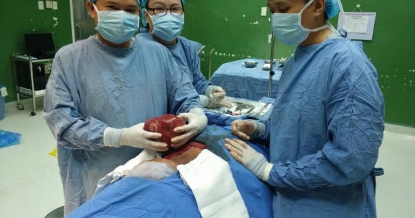 Đà Nẵng: Phẫu thuật khối u nặng 2 kg ở vùng cổ nữ bệnh nhân 68 tuổi