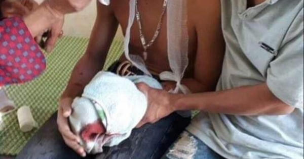 Hà Tĩnh: Laptop đang sạc pin phát nổ, 3 học sinh nhập viện