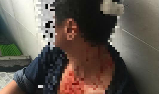 Vụ bất ngờ bị đối tượng từng có tiền án cùng nhóm người hành hung: Nạn nhân bị chấn thương sọ não