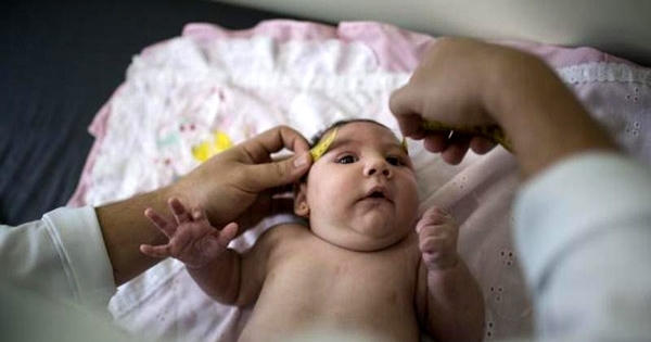 Việt Nam phát hiện trường hợp trẻ sơ sinh đầu tiên nghi mắc chứng đầu nhỏ do virus Zika Việt Nam phát hiện trường hợp trẻ sơ sinh đầu tiên nghi mắc chứng đầu nhỏ do virus Zika