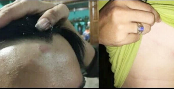 Thừa Thiên - Huế: Điều tra nhóm người tự xưng công an xã chặn đánh thương lái trong đêm