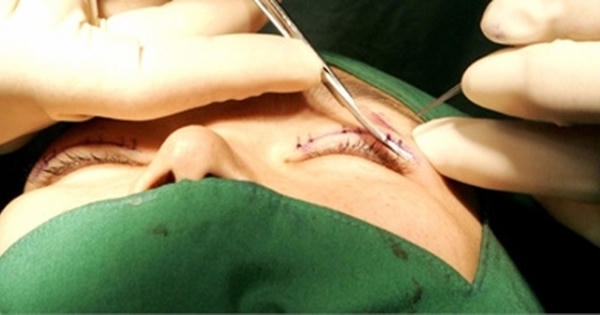 Ký ức đau đớn của ca sĩ Việt chuyển giới trên đất Thái