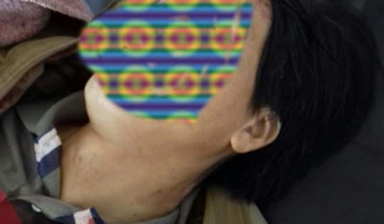 Lâm Đồng: Về thăm nhà, con trai bị cha ruột đâm tử vong