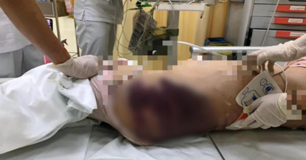 Bắt khẩn cấp “dì ghẻ” nghi bạo hành bé gái 8 tuổi tử vong ở TP HCM