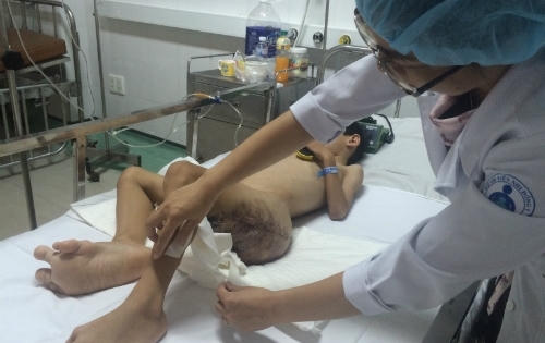 Cậu bé 6 tuổi mang nhiều bướu máu dũng cảm đối mặt cái chết