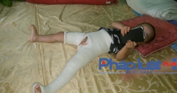 Cô giáo đạp gãy xương đùi học trò 3 tuổi phạm tội cố ý gây thương tích?