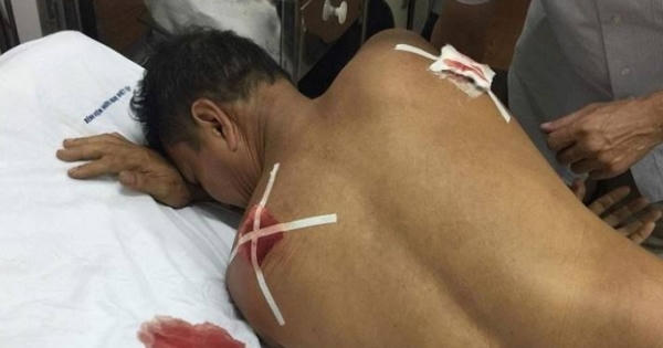 Hải Phòng: Bị nhắc nhở, nam thanh niên vác dao đâm gục hàng xóm