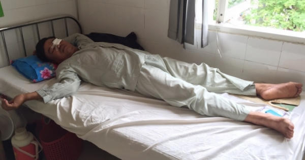 Thừa Thiên – Huế: Bị đánh hỏng 1 mắt vì “xin” hát 1 bài