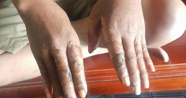 Nghệ An: Điều tra nhóm đối tượng hung hãn chém lái xe và phụ xe khách trọng thương