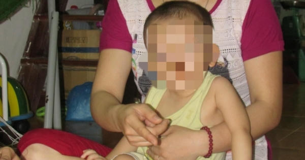Mẹ khóc ròng chứng kiến con 20 tháng tuổi bị cắn bầm tím người
