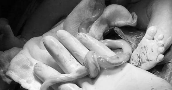 Bác sĩ bỏ ngang ca khám bệnh, lao vào phòng mổ cứu bé sơ sinh Bác sĩ bỏ ngang ca khám bệnh, lao vào phòng mổ cứu bé sơ sinh