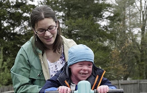 Mắc phải căn bệnh lạ, cậu bé sẽ chết nếu không tắm 2 lần một ngày