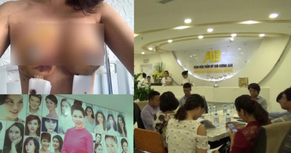 Bơm Silicon nhu cầu làm đẹp chính đáng nhưng dễ dàng hứng chịu di chứng