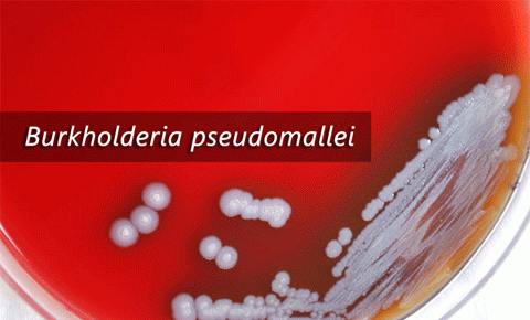 Cảnh giác với căn bệnh nguy hiểm đang bị "lãng quên"