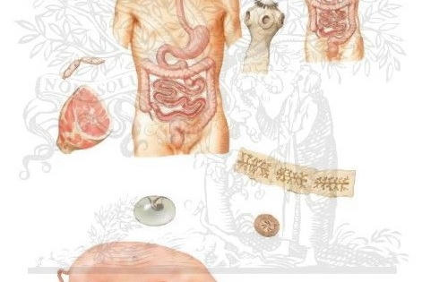 Bệnh sán dây lợn ở người: Hệ luỵ đáng sợ và cách phòng tránh