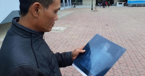 Vụ "quên kéo" trong bụng bệnh nhân 18 năm: Nếu ở thời điểm này thì rất nghiêm trọng