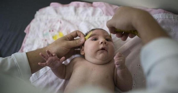 "Mối quan hệ tay ba" giữa virus Zika, chứng đầu nhỏ và hội chứng Guillain-Barré "Mối quan hệ tay ba" giữa virus Zika, chứng đầu nhỏ và hội chứng Guillain-Barré