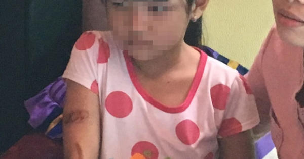 Kiên Giang: Nghi án bé gái 7 tuổi bị cha và mẹ kế bạo hành dã man