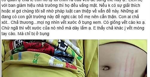 Sơn La: Nghi án một bé trai bị tổn thương bộ phận sinh dục sau khi đi học về