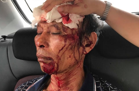 Nóng: Côn đồ xông vào nhà nổ súng truy sát, 3 người nhập viện tại Thanh Hóa