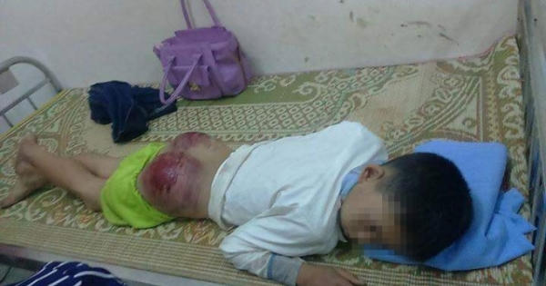 Vụ cháu bé bị bố đánh ở Thái Nguyên: Vì bỏ học nhiều ngày và ham chơi điện tử