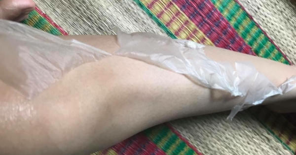 Sự thật mỹ phẩm trắng da hiệu Cozy: Nga Mona Spa lột da, bán mỹ phẩm không nguồn gốc xuất xứ?