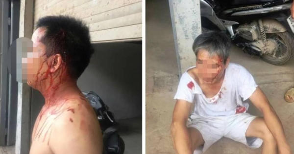 Hà Nội: Hỗn chiến vì… bức tường rào, hai người nhập viện