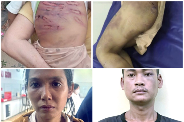 Bắt giữ khẩn cấp người phụ nữ cùng nhân tình hành hạ dã man bé trai 2 tuổi