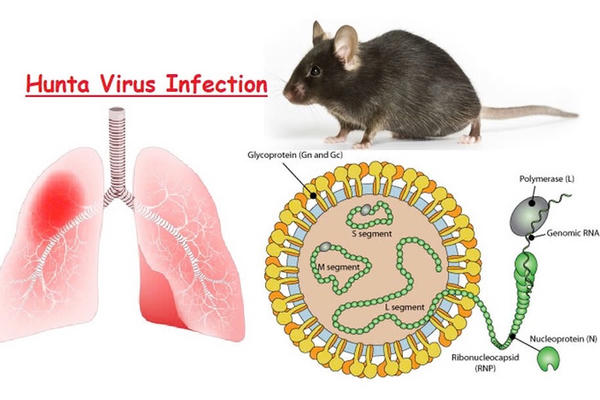 Không hoang mang nhưng tuyệt đối không chủ quan với vi rút Hanta