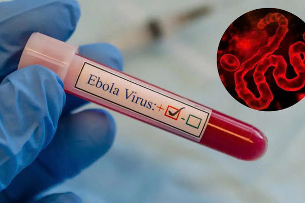 Bộ Y tế siết kiểm soát người nhập cảnh từ vùng dịch Ebola