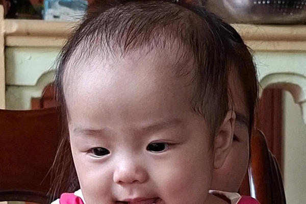 Bé vừa lọt lòng đã có răng: Sự thật phía sau hiện tượng hiếm gặp Bé vừa lọt lòng đã có răng: Sự thật phía sau hiện tượng hiếm gặp