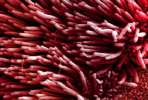 Có những triệu chứng này nghĩ ngay ung thư phổi