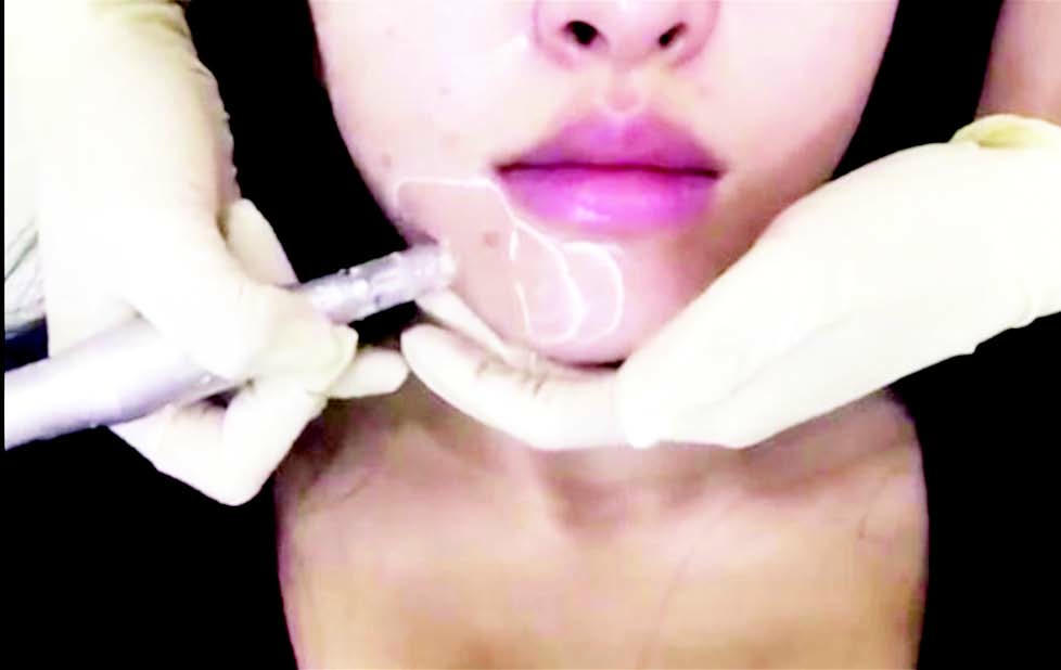 Kết quả hình ảnh cho cấy phấn vào da