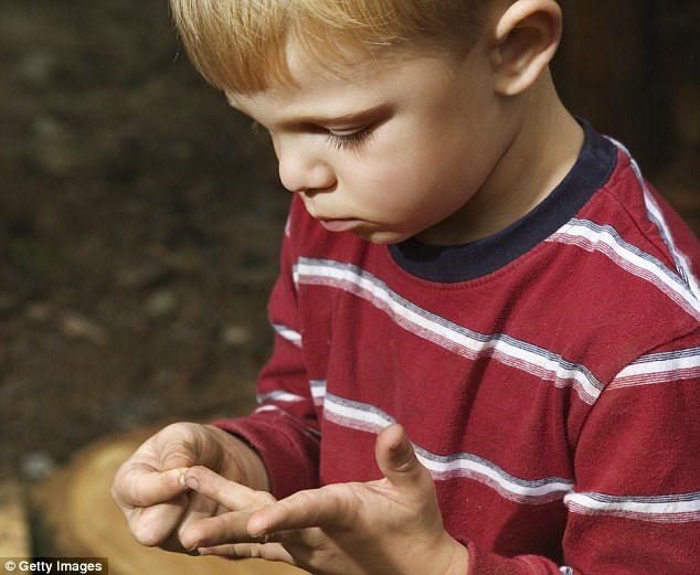 Kết quả hình ảnh cho dằm đâm vào tay