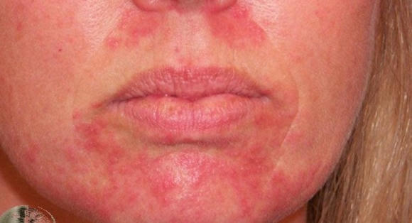 doc-to-trong-co-the-ngoisao.vn.jpg 0