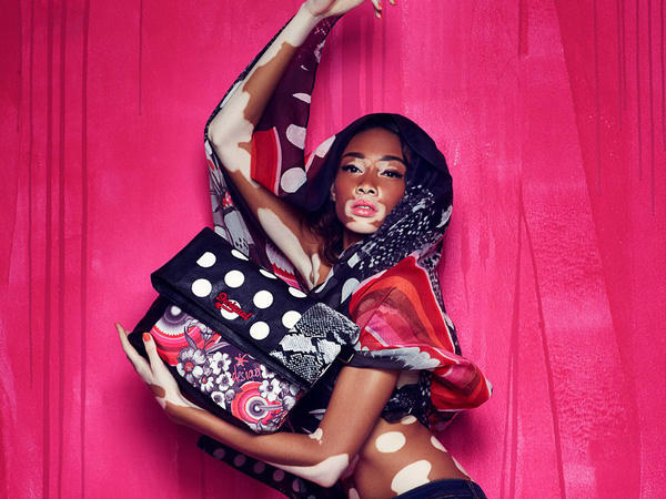 vẻ đẹp đạc biệt của làng thời trang Chantelle Brown Young