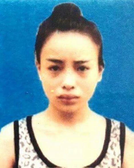 Yến khi chưa phẫu thuật thẩm mĩ.