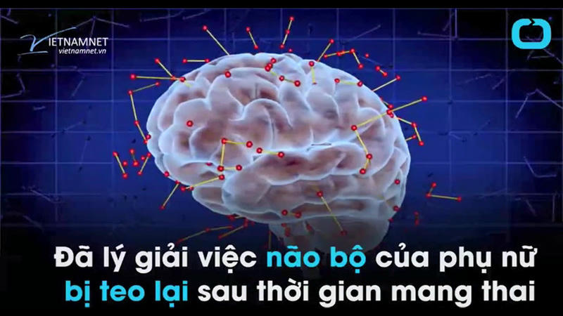 mang thai, phụ nữ có thai, não bộ
