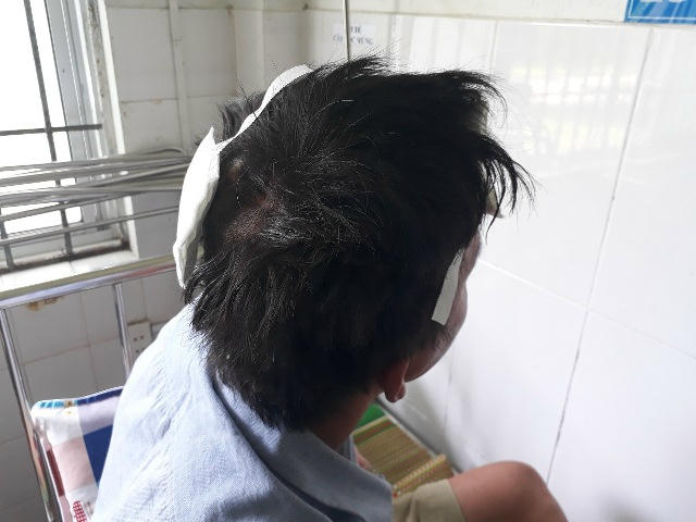 Cãi vã với C. liên quan tỷ lệ kèo khiến anh A. bị chém. Ảnh: CA Quảng Nam.