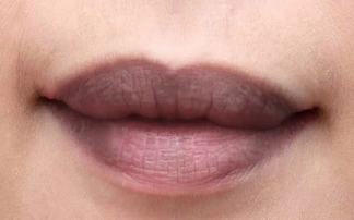 Kết quả hình ảnh cho môi,bị bệnh