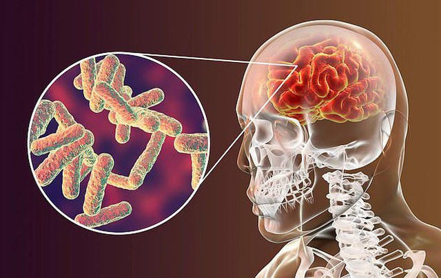 Căn bệnh NSƯT Tuấn Phương mắc phải tiềm tàng trong món ăn khoái khẩu - 2