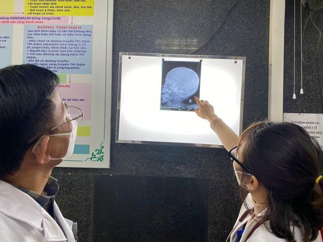 Bé gái bị đóng đinh vào đầu vẫn trong tình trạng rất nặng, chưa thể phẫu thuật - Ảnh 2.